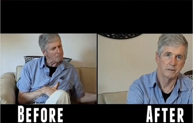 ماری جوانا درمان پارکینسون